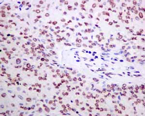 Immunohistochemistry (Formalin/PFA-fixed paraffin-embedded sections) - Anti-TAF15 antibody [EPR9196(B)] (AB133760)