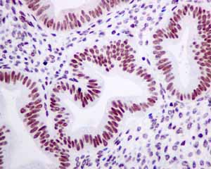 Immunohistochemistry (Formalin/PFA-fixed paraffin-embedded sections) - Anti-TAF15 antibody [EPR9196(B)] (AB133760)