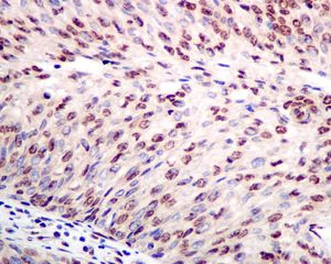 Immunohistochemistry (Formalin/PFA-fixed paraffin-embedded sections) - Anti-TAF15 antibody [EPR9197(B)] (AB134916)