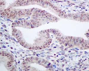 Immunohistochemistry (Formalin/PFA-fixed paraffin-embedded sections) - Anti-TAF15 antibody [EPR9197(B)] (AB134916)