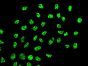 Immunocytochemistry/ Immunofluorescence - Anti-TAF15 antibody [EPR9197(B)] - BSA and Azide free (AB235079)