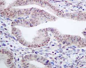 Immunohistochemistry (Formalin/PFA-fixed paraffin-embedded sections) - Anti-TAF15 antibody [EPR9197(B)] - BSA and Azide free (AB235079)