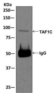 Immunoprecipitation - Anti-TAF1C antibody [EPR11298] - BSA and Azide free (AB250064)