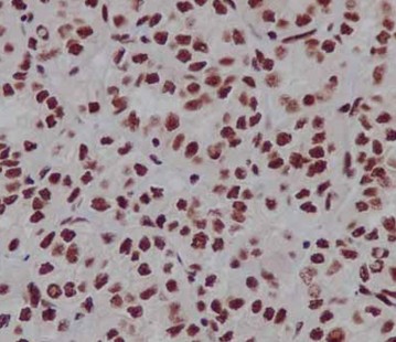 Immunohistochemistry (Formalin/PFA-fixed paraffin-embedded sections) - Anti-TAF3 antibody [EPR15598] (AB188332), expandable thumbnail