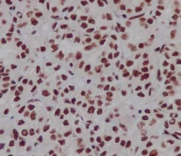 Immunohistochemistry (Formalin/PFA-fixed paraffin-embedded sections) - Anti-TAF3 antibody [EPR15598] (AB188332)