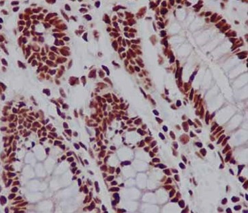 Immunohistochemistry (Formalin/PFA-fixed paraffin-embedded sections) - Anti-TAF3 antibody [EPR15598] (AB188332), expandable thumbnail