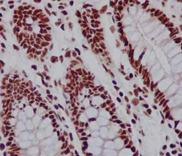 Immunohistochemistry (Formalin/PFA-fixed paraffin-embedded sections) - Anti-TAF3 antibody [EPR15598] (AB188332)