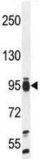 Western blot - Anti-TAF4B antibody - C-terminal (AB189428)