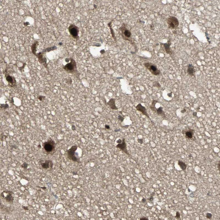 Immunohistochemistry (Formalin/PFA-fixed paraffin-embedded sections) - Anti-TAF5 antibody (AB251684)