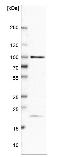 Western blot - Anti-TAF5 antibody (AB251684)