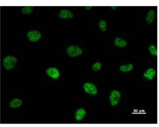 Immunocytochemistry - Anti-TAF6 antibody [585D4a] (AB51026)