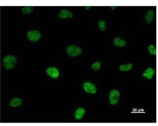 Immunocytochemistry - Anti-TAF6 antibody [585D4a] (AB51026)