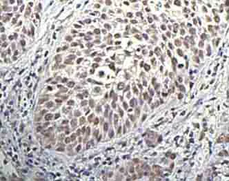 Immunohistochemistry (Formalin/PFA-fixed paraffin-embedded sections) - Anti-TAF7 antibody [2C5] (AB57494)