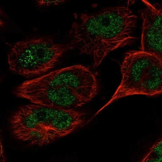 Immunocytochemistry/ Immunofluorescence - Anti-TAF8/TBN antibody (AB204894)