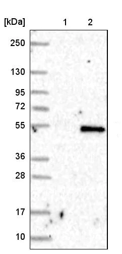 Western blot - Anti-TAF8/TBN antibody (AB204894)