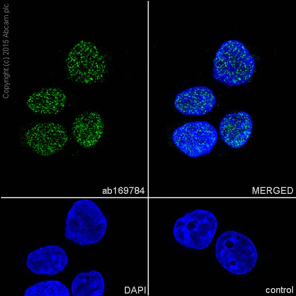 Immunocytochemistry/ Immunofluorescence - Anti-TAF9 antibody [EPR12075(B)] - BSA and Azide free (AB249526)