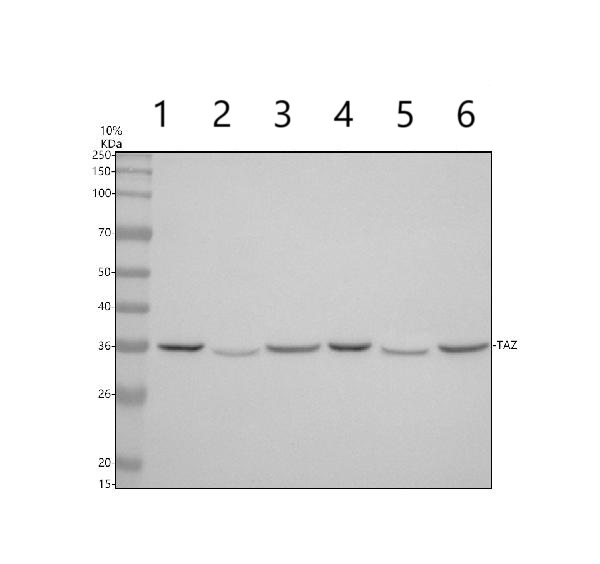 Western blot - Anti-Tafazzin / TAZ antibody (AB176396)
