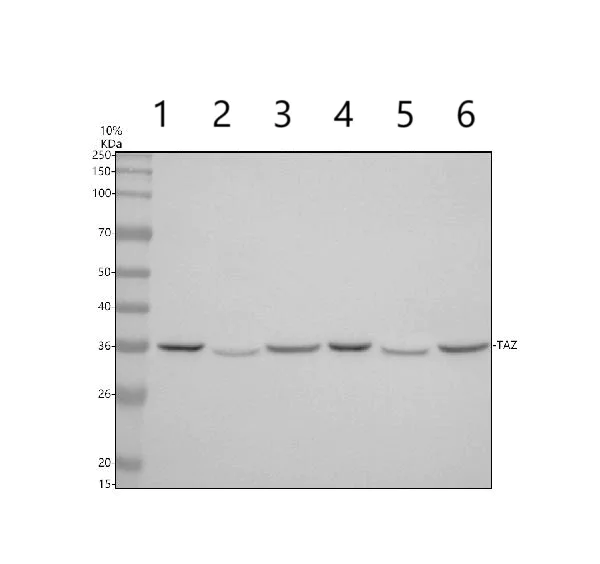 Western blot - Anti-Tafazzin / TAZ antibody (AB176396)