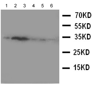 Western blot - Anti-Tafazzin / TAZ antibody (AB176396), expandable thumbnail