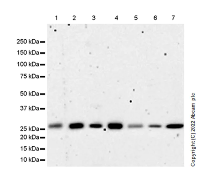 Western blot - Anti-Tafazzin/TAZ antibody [EPR26956-58] (AB307148)