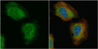 Immunocytochemistry/ Immunofluorescence - Anti-TAGLN/Transgelin antibody (AB137453)