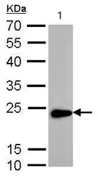 Western blot - Anti-TAGLN/Transgelin antibody (AB137453)