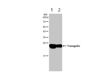 Western blot - Anti-TAGLN/Transgelin antibody (AB137453)