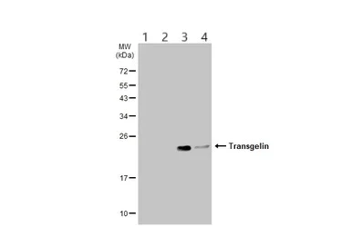 Western blot - Anti-TAGLN/Transgelin antibody (AB137453)