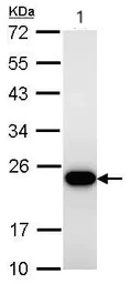 Western blot - Anti-TAGLN/Transgelin antibody (AB137453)