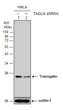 Western blot - Anti-TAGLN/Transgelin antibody (AB137453)