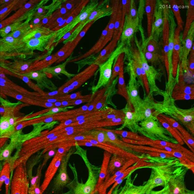 Immunocytochemistry/ Immunofluorescence - Anti-TAGLN/Transgelin antibody (AB14106)