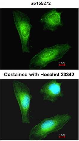 Immunocytochemistry/ Immunofluorescence - Anti-TAGLN/Transgelin antibody (AB155272), expandable thumbnail