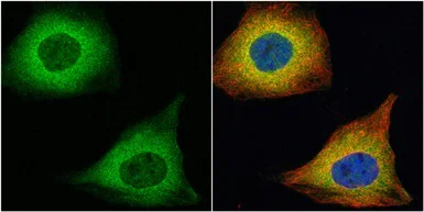Immunocytochemistry/ Immunofluorescence - Anti-TAGLN/Transgelin antibody (AB155272)