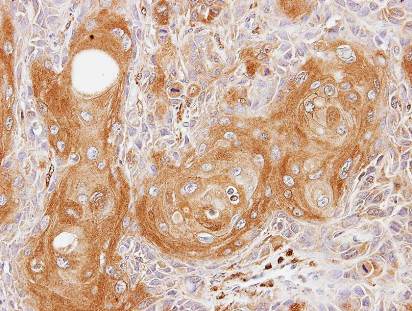 Immunohistochemistry (Formalin/PFA-fixed paraffin-embedded sections) - Anti-TAGLN/Transgelin antibody (AB155272), expandable thumbnail
