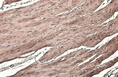Immunohistochemistry (Formalin/PFA-fixed paraffin-embedded sections) - Anti-TAGLN/Transgelin antibody (AB155272)