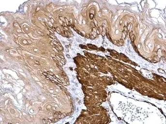 Immunohistochemistry (Formalin/PFA-fixed paraffin-embedded sections) - Anti-TAGLN/Transgelin antibody (AB155272)