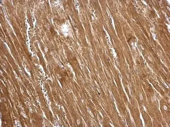 Immunohistochemistry (Formalin/PFA-fixed paraffin-embedded sections) - Anti-TAGLN/Transgelin antibody (AB155272)