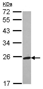 Western blot - Anti-TAGLN/Transgelin antibody (AB155272), expandable thumbnail