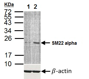 Western blot - Anti-TAGLN/Transgelin antibody (AB155272), expandable thumbnail
