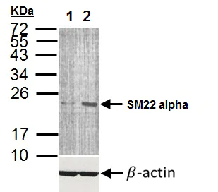 Western blot - Anti-TAGLN/Transgelin antibody (AB155272)