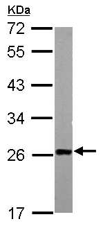 Western blot - Anti-TAGLN/Transgelin antibody (AB155272)