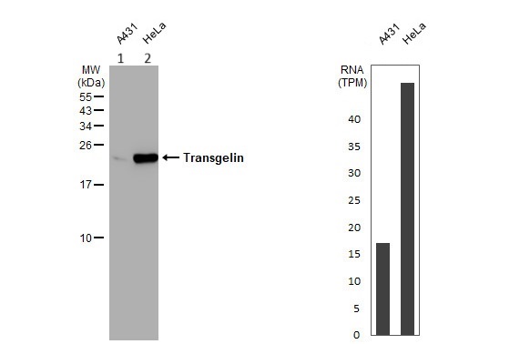 Anti-TAGLN/Transgelin antibody