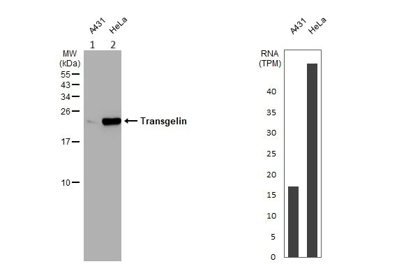 Western blot - Anti-TAGLN/Transgelin antibody (AB155272)