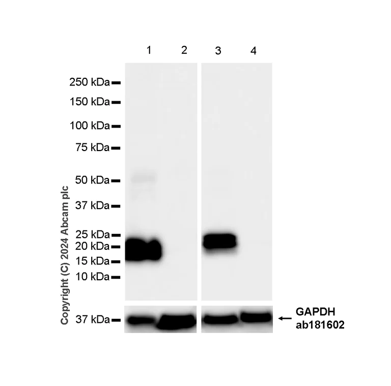 Western blot - Anti-TAGLN/Transgelin antibody [EPR11995(B)] (AB170902)