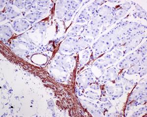 Immunohistochemistry (Formalin/PFA-fixed paraffin-embedded sections) - Anti-TAGLN/Transgelin antibody [EPR11995(B)] - BSA and Azide free (AB249579), expandable thumbnail