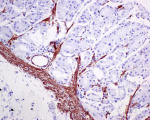 Immunohistochemistry (Formalin/PFA-fixed paraffin-embedded sections) - Anti-TAGLN/Transgelin antibody [EPR11995(B)] - BSA and Azide free (AB249579)