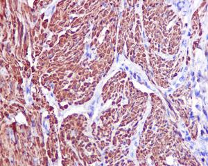 Immunohistochemistry (Formalin/PFA-fixed paraffin-embedded sections) - Anti-TAGLN/Transgelin antibody [EPR11995(B)] - BSA and Azide free (AB249579), expandable thumbnail