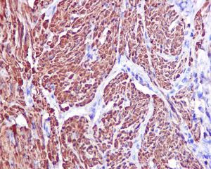 Immunohistochemistry (Formalin/PFA-fixed paraffin-embedded sections) - Anti-TAGLN/Transgelin antibody [EPR11995(B)] - BSA and Azide free (AB249579)