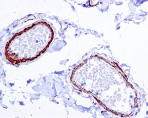 Immunohistochemistry (Formalin/PFA-fixed paraffin-embedded sections) - Anti-TAGLN/Transgelin antibody [EPR11995(B)] - BSA and Azide free (AB249579), expandable thumbnail