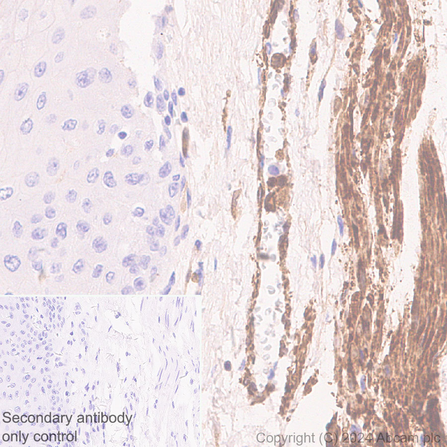Immunohistochemistry (Formalin/PFA-fixed paraffin-embedded sections) - Anti-TAGLN/Transgelin antibody [EPR11995(B)] - BSA and Azide free (ab249579), expandable thumbnail